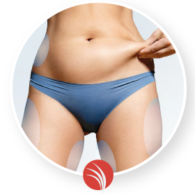 coolsculpting coolsculpting Palermo
