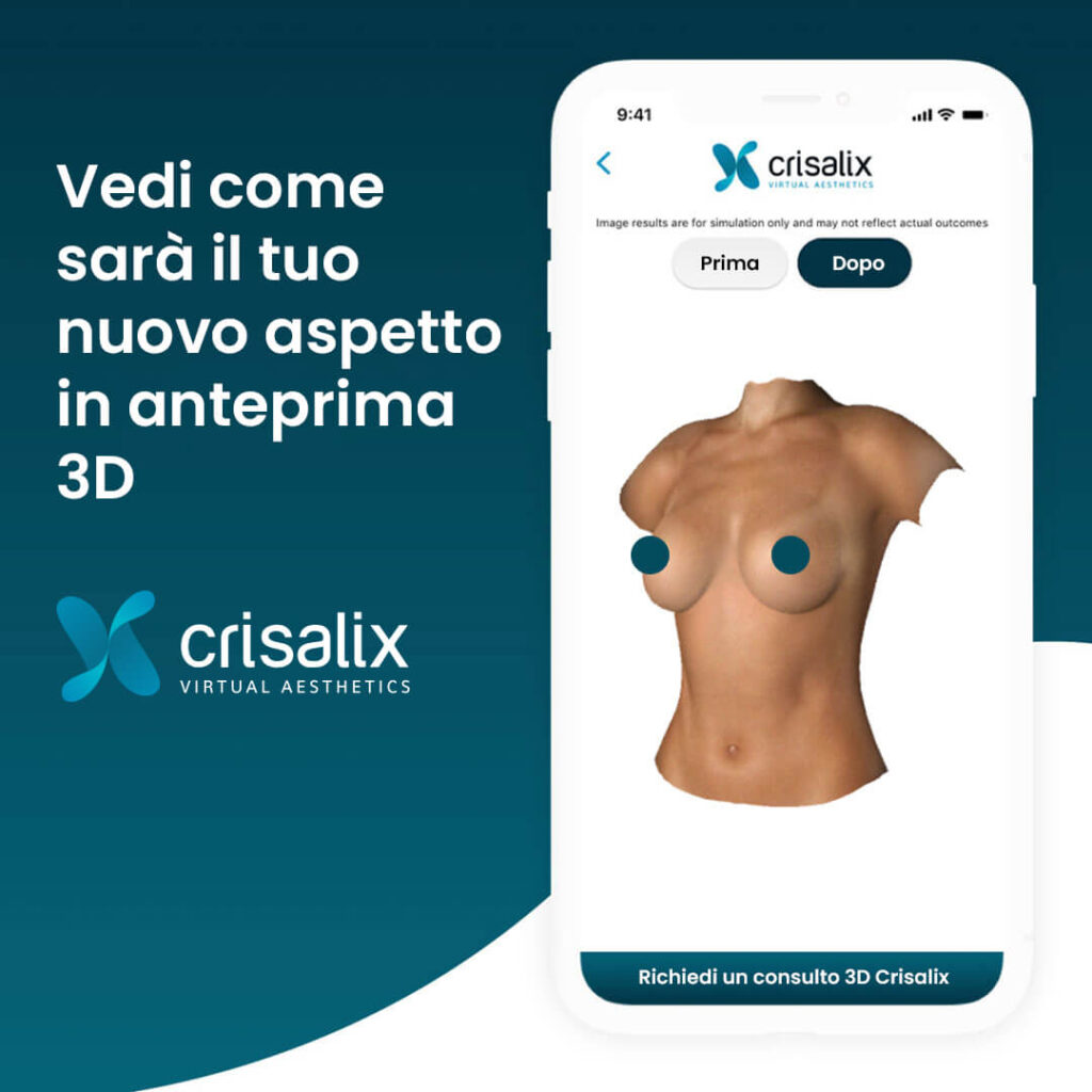 simulazione 3D mastoplastica additiva
