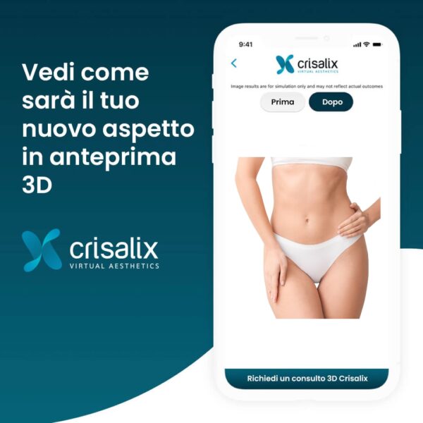 Crisalix Crisalix